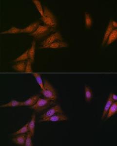 Anti-p23 Rabbit Monoclonal Antibody [clone: ARC1986]