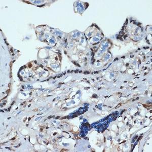 Immunohistochemistry analysis of paraffin-embedded human placenta using Anti-HOXA9 Antibody [ARC2423] (A305943) at a dilution of 1:100 (40X lens). Perform microwave antigen retrieval with 10 mM Tris/EDTA buffer pH 9.0 before commencing with IHC staining protocol