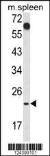 Anti-CD7 Rabbit Polyclonal Antibody