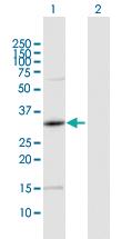 Anti-PRKAG1 Rabbit Polyclonal Antibody