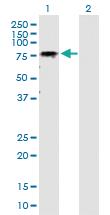 Anti-GALNT6 Rabbit Polyclonal Antibody