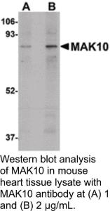 Anti-NAA35 Rabbit Polyclonal Antibody