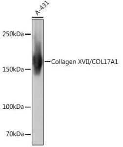 Western blot analysis of extracts of A-431 cells, using Anti-Collagen XVII Antibody [ARC0233] (A308839) at 1:1,000 dilution. The secondary antibody was Goat Anti-Rabbit IgG H&L Antibody (HRP) at 1:10,000 dilution.