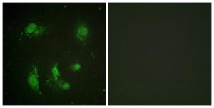 Immunofluorescence analysis of HeLa cells using Anti-Survivin Antibody. The right hand panel represents a negative control, where the antibody was pre-incubated with the immunising peptide