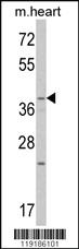 Anti-WNT1 Rabbit Polyclonal Antibody