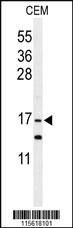 Anti-MCPH1 Rabbit Polyclonal Antibody