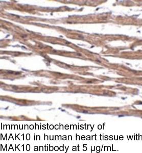 Anti-NAA35 Rabbit Polyclonal Antibody