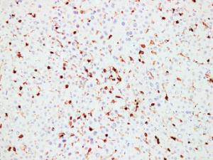 Anti-CD45 antibody