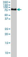 Anti-GALNT6 Mouse Monoclonal Antibody [clone: 4C10]