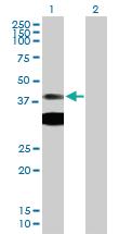 Anti-PRKAR1A Mouse Polyclonal Antibody