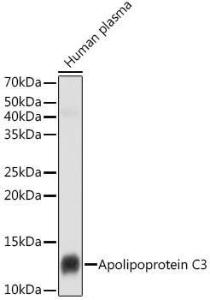 Western blot analysis of extracts of Human plasma cells, using Anti-Apolipoprotein CIII Antibody [ARC1886] (A307674) at 1:1000 dilution