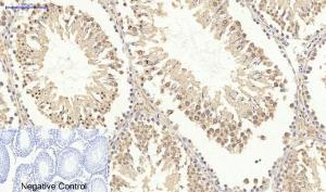 Immunohistochemical analysis of paraffin-embedded rat testis tissue using Anti-Survivin Antibody at 1:200 (4°C overnight). Negative control was secondary antibody only