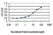 Anti-ATP2A3 Mouse monoclonal antibody [clone: 2H3]