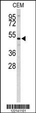 Anti-CNDP1 Rabbit Polyclonal Antibody