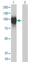 Anti-GALNT6 Mouse Monoclonal Antibody [clone: 4C10]