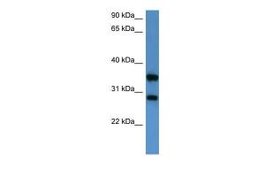 Anti-STYXL1 Rabbit Polyclonal Antibody