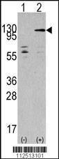 Anti-TAOK3 Rabbit Polyclonal Antibody (HRP (Horseradish Peroxidase))