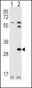 Anti-STAP1 Rabbit Polyclonal Antibody (FITC (Fluorescein))