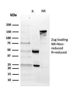 Anti-CD10 Mouse Monoclonal Antibody [clone: MME/4232]