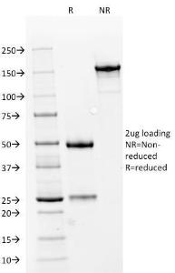 SDS-PAGE analysis of Anti-Carbonic Anhydrase IX Antibody [66.4.C2] under non-reduced and reduced conditions; showing intact IgG and intact heavy and light chains, respectively. SDS-PAGE analysis confirms the integrity and purity of the antibody