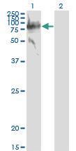 Anti-SERPING1 Mouse Monoclonal Antibody [clone: 3F4-1D9]