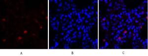 Immunofluorescence analysis of rat lung tissue using Anti-Survivin Antibody (red) at 1:200 (4°C overnight). Cy3 labelled secondary antibody was used at 1:300 (RT 50min). Panel A: Target. Panel B: DAPI. Panel C: Merge