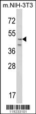 Anti-CRHR2 Rabbit Polyclonal Antibody