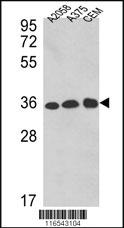 Anti-GAPDH Rabbit Polyclonal Antibody