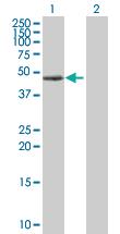 Anti-PRKAR1A Rabbit Polyclonal Antibody