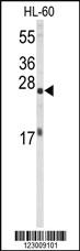 Anti-EIF4E Rabbit Polyclonal Antibody