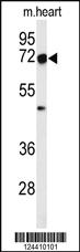 Anti-DCLRE1C Rabbit Polyclonal Antibody