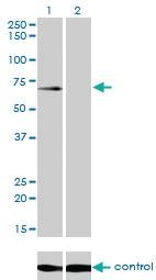 Anti-GALNT6 Mouse Monoclonal Antibody [clone: 4C10]