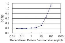 Anti-DGKA Polyclonal Antibody Pair