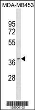 Anti-OR11A1 Rabbit Polyclonal Antibody (APC (Allophycocyanin))