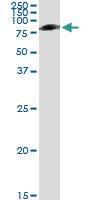 Anti-SERPING1 Mouse Monoclonal Antibody [clone: 3F4-1D9]