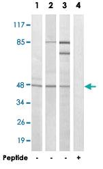 Anti-FOXB2 Rabbit Polyclonal Antibody