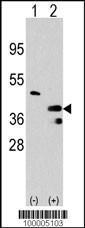 Anti-PRMT1 Rabbit Polyclonal Antibody (APC (Allophycocyanin))