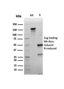 SDS-PAGE analysis of Anti-NAPSIN A Antibody [rNAPSA/6926] under non-reduced and reduced conditions; showing intact IgG and intact heavy and light chains, respectively. SDS-PAGE analysis confirms the integrity and purity of the antibody.