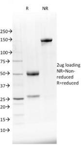 Anti-NKX2.8 antibody