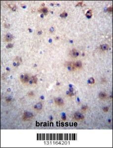 Anti-EVPLL Rabbit Polyclonal Antibody