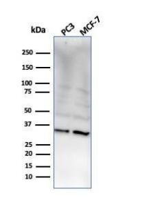 Anti-NKX28 antibody