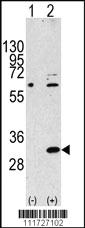 Anti-EIF4E2 Rabbit Polyclonal Antibody