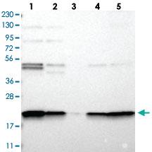 Anti-TMEM109 Rabbit Polyclonal Antibody