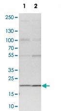 Anti-TMEM109 Rabbit Polyclonal Antibody