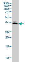 Anti-SMAD3 Mouse Monoclonal Antibody [clone: 7F3]