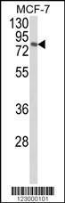 Anti-MAPK8IP1 Rabbit Polyclonal Antibody (FITC (Fluorescein))