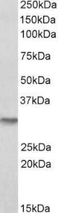 Antibody anti-NQO1 A82564-100 100 µg