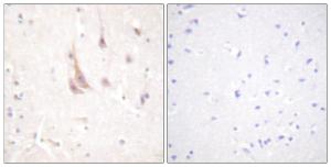 Anti-PKC zeta antibody