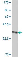 Anti-IL17F Mouse Polyclonal Antibody