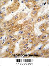 Anti-ALDH4A1 Rabbit Polyclonal Antibody